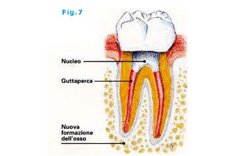 andriano-guidi-endodonzia